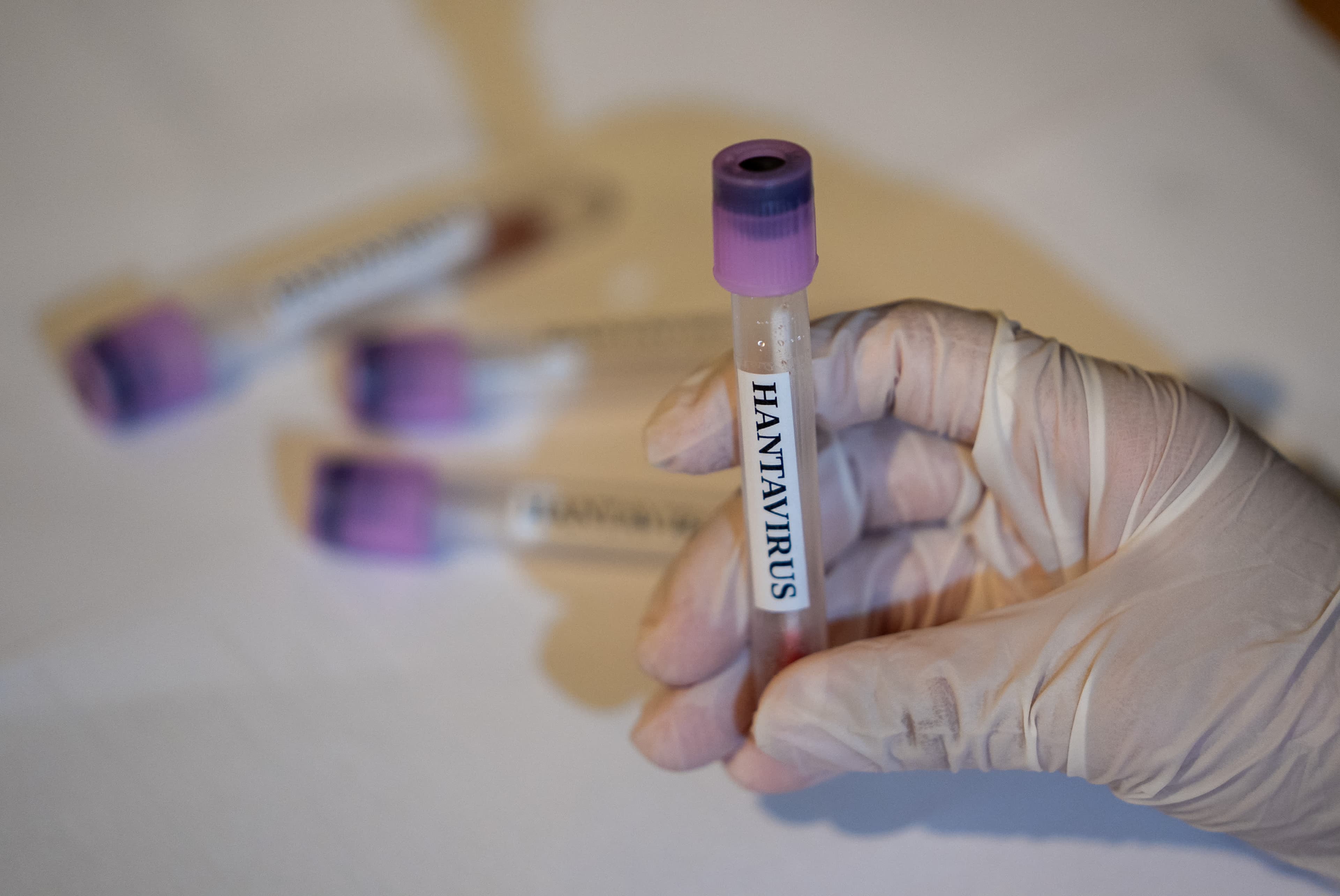 CDC Monitors 41 Hantavirus Cases; Public Risk Remains Low