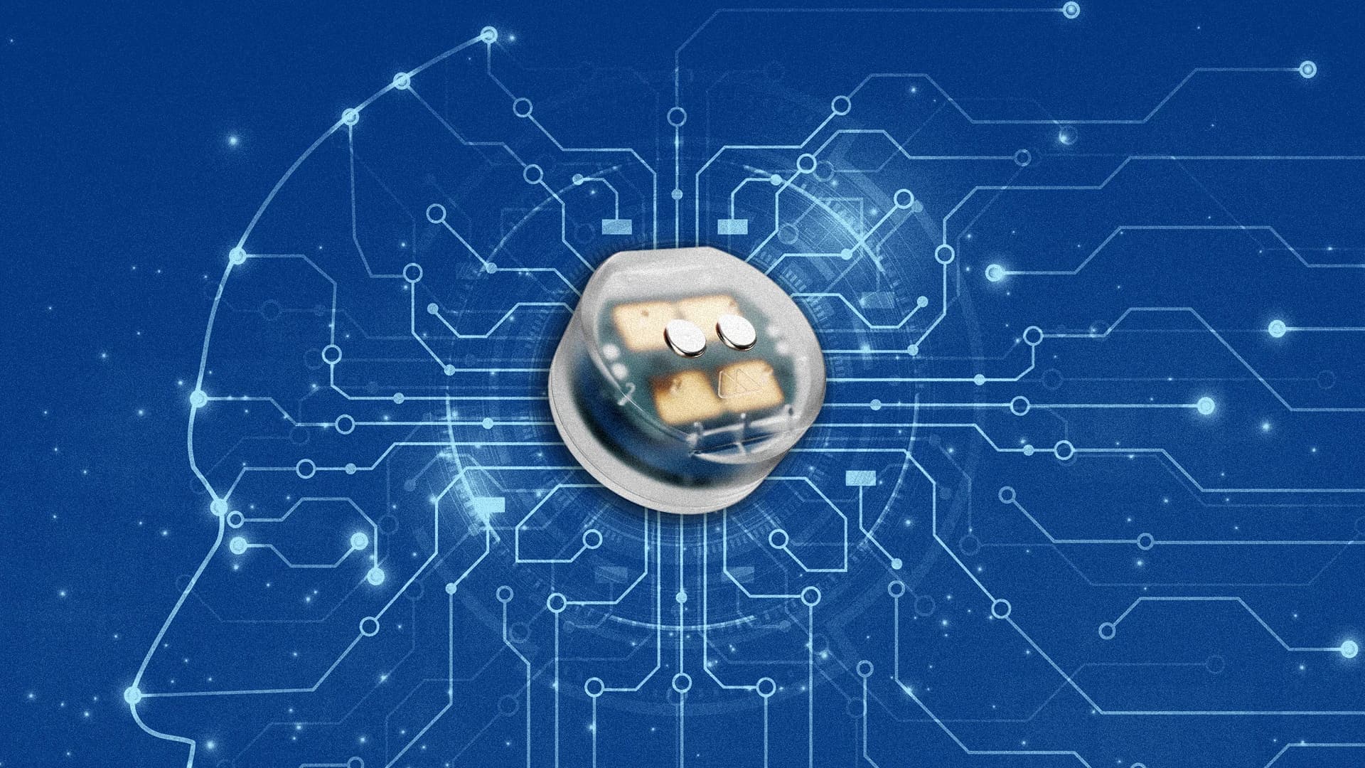 Brain Implant for Depression Advances to Human Trials